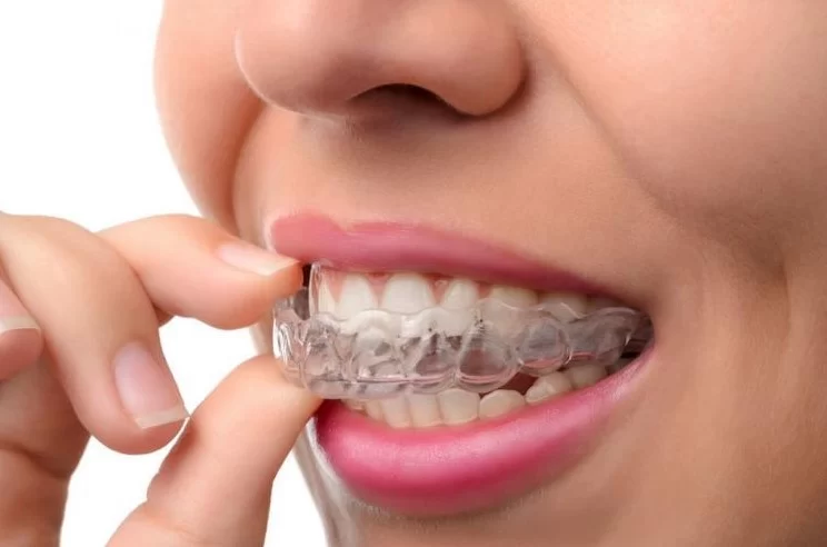 Best Ways to Prevent Teeth Grinding at Night for Healthy Teeth