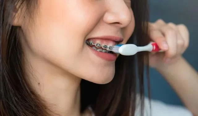 Essential Dental Care Tips for Orthodontic Patients to Maintain Healthy Teeth