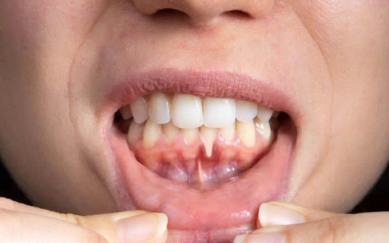 Effective Ways to Maintain Oral Hygiene During Illness and Recovery Phases