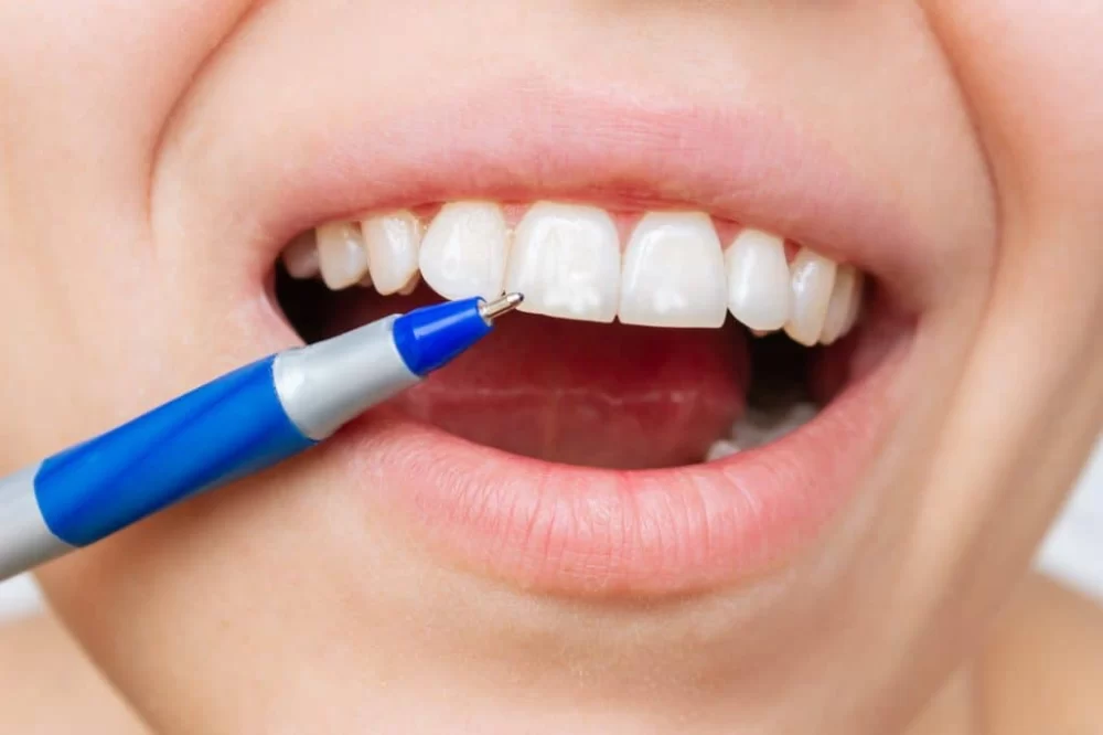 Effective Methods to Treat White Patches in Mouth and Maintain Oral Health