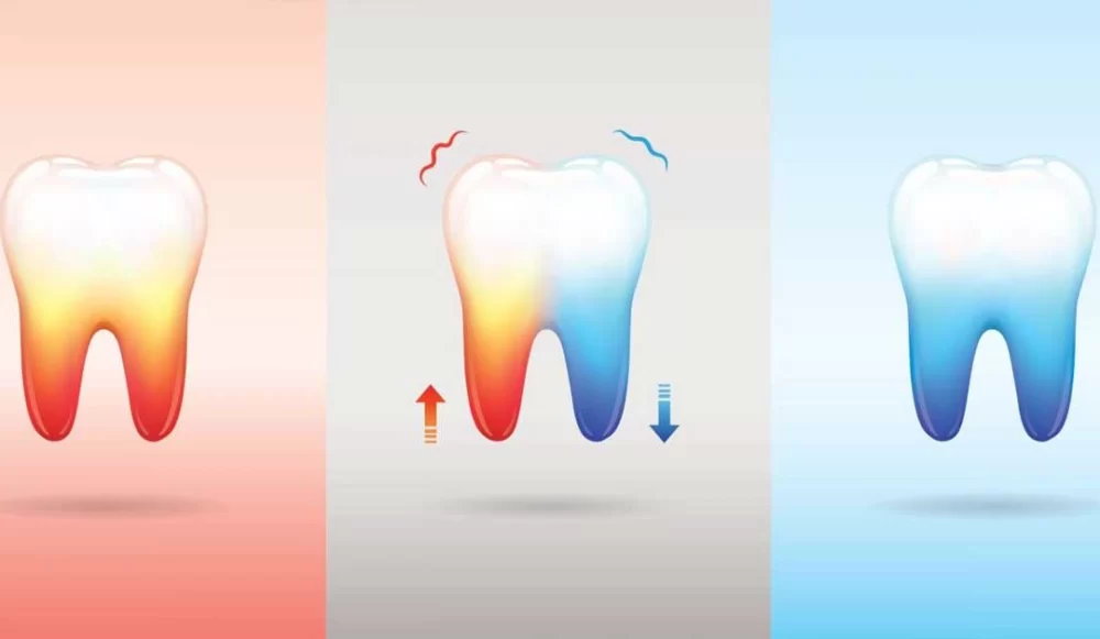 Understanding Tooth Sensitivity Causes and Effective Treatments for Lasting Relief