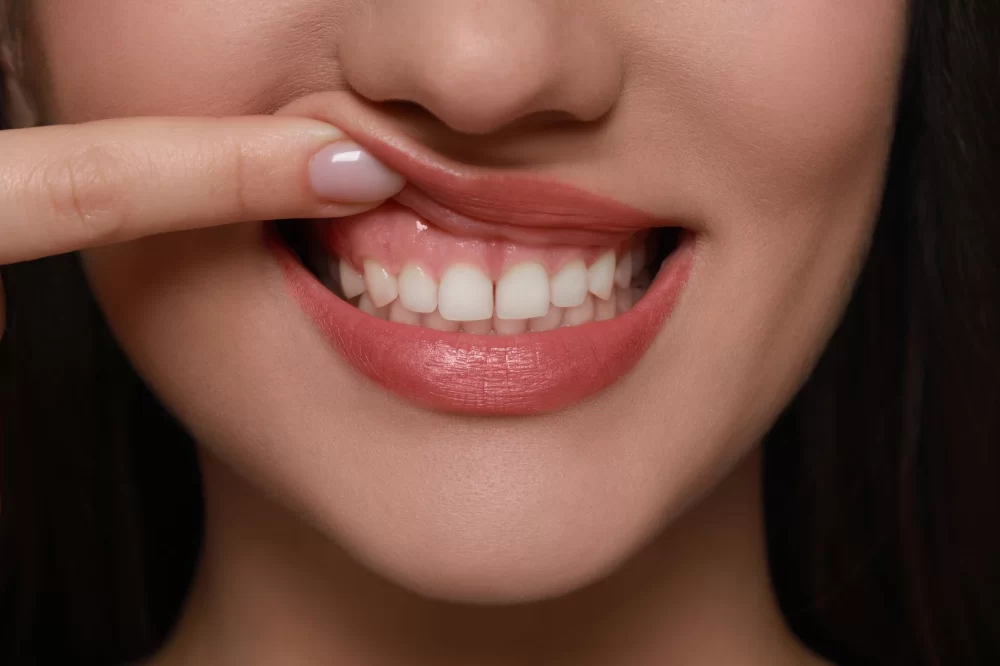Proven Strategies on How to Prevent Gingivitis for Healthy Gums