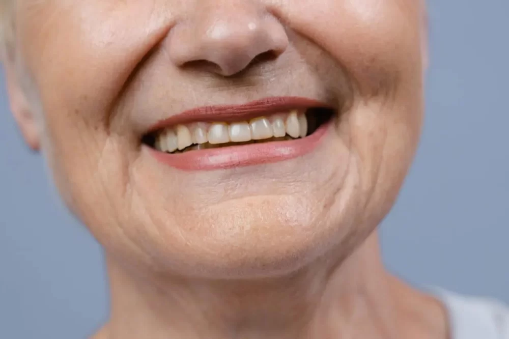 Understanding Causes of Tooth Discoloration After Dental Work and Effective Solutions