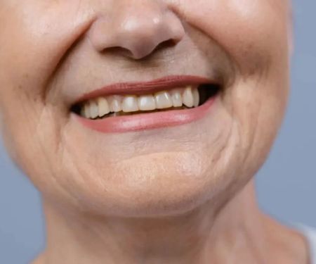 Understanding Causes of Tooth Discoloration After Dental Work and Effective Solutions
