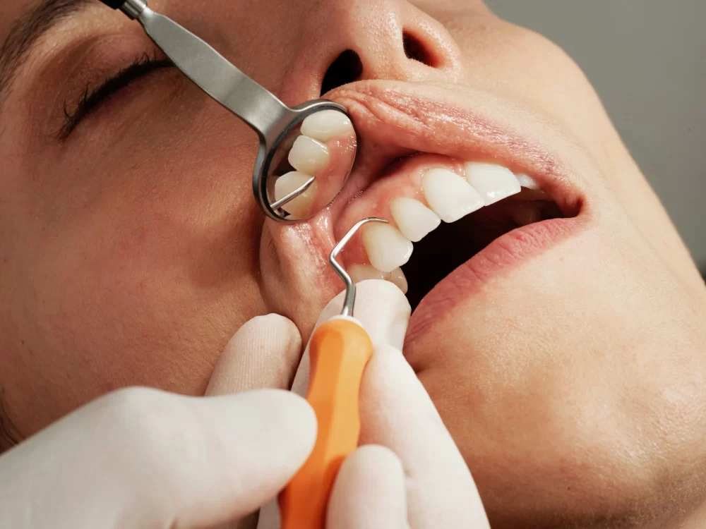 Why Regular Dental Cleaning and Oral Checkups Are Essential for Your Health