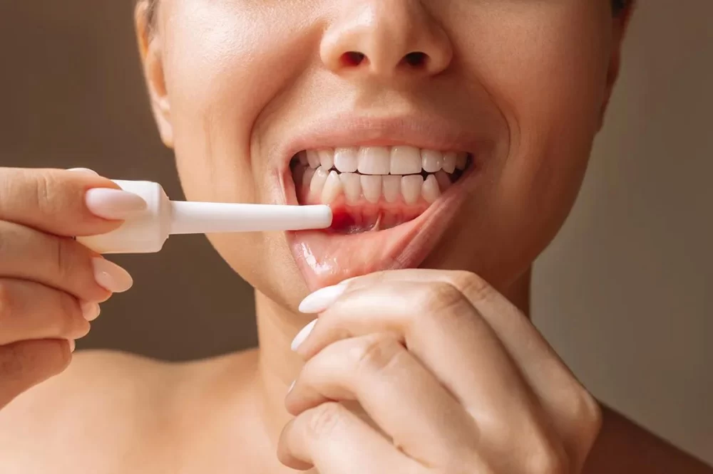 Effective Ways to Treat Tooth Infection Naturally and Safely at Home