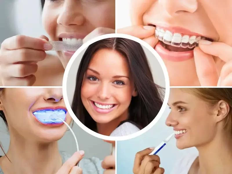 How to Whiten Teeth Safely at Home Without Damage: Expert Tips and Advice