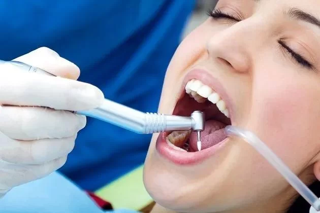 Best Practices for Caring for Dental Crowns After Root Canal Treatment