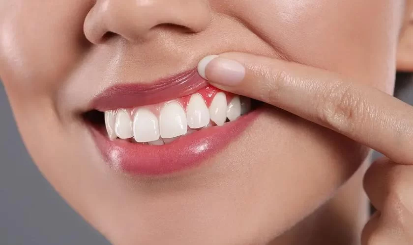 How to Treat Gum Recession Effectively and Protect Your Smile