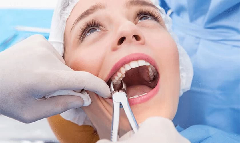 Comprehensive Guide on How to Maintain Oral Hygiene After Tooth Extraction Surgery and Care