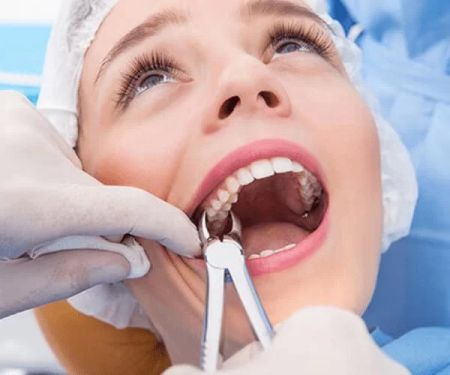 Comprehensive Guide on How to Maintain Oral Hygiene After Tooth Extraction Surgery and Care