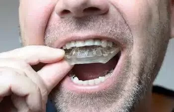 Effective Ways to Prevent Teeth Grinding at Night and Protect Your Smile