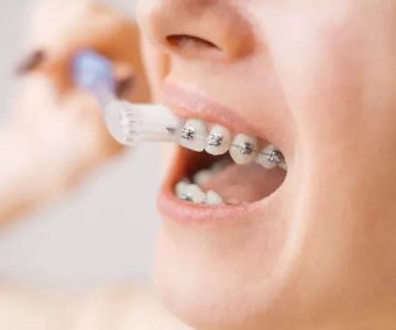 Effective Ways to Manage Oral Pain from Braces for Comfortable Orthodontic Care