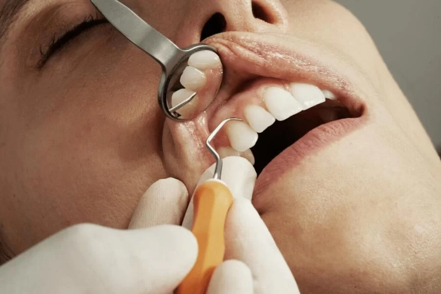 Effective Natural Methods to Relieve Swollen Gums and Improve Oral Health
