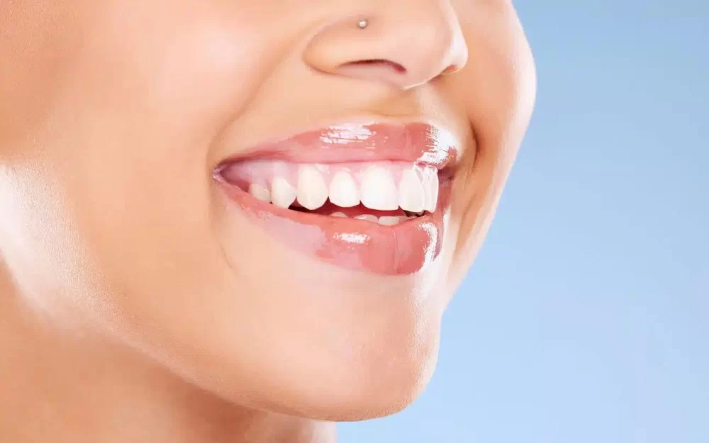 Effective Long Term Maintenance and Care for Dental Veneers