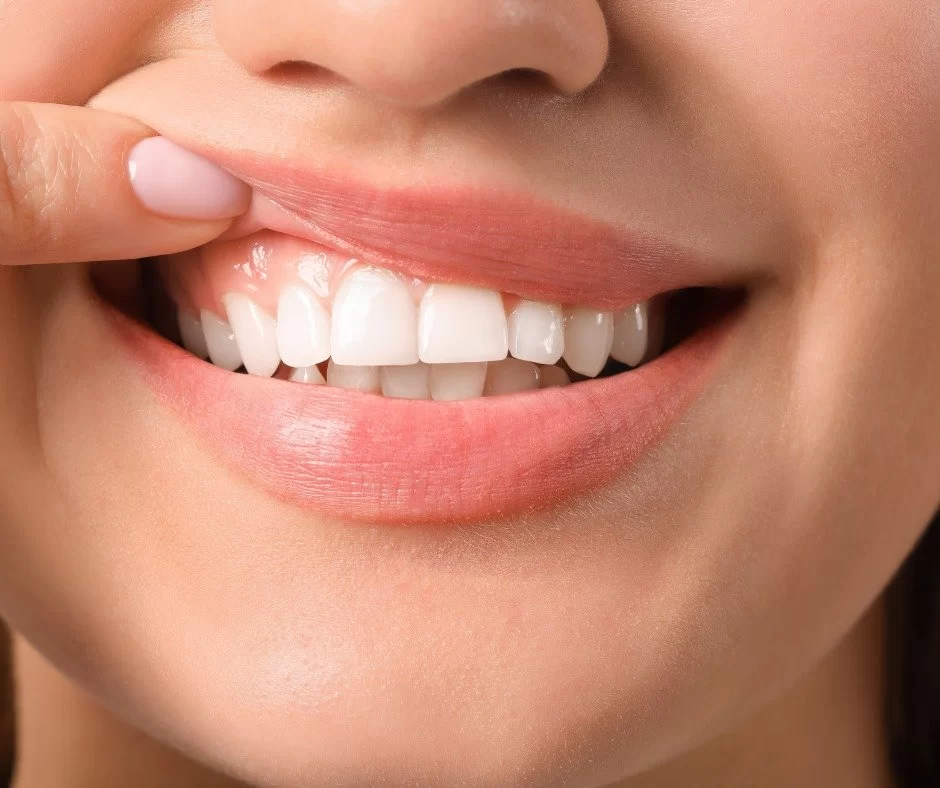 Understanding the Causes of White Spots on Gums and How to Address Them