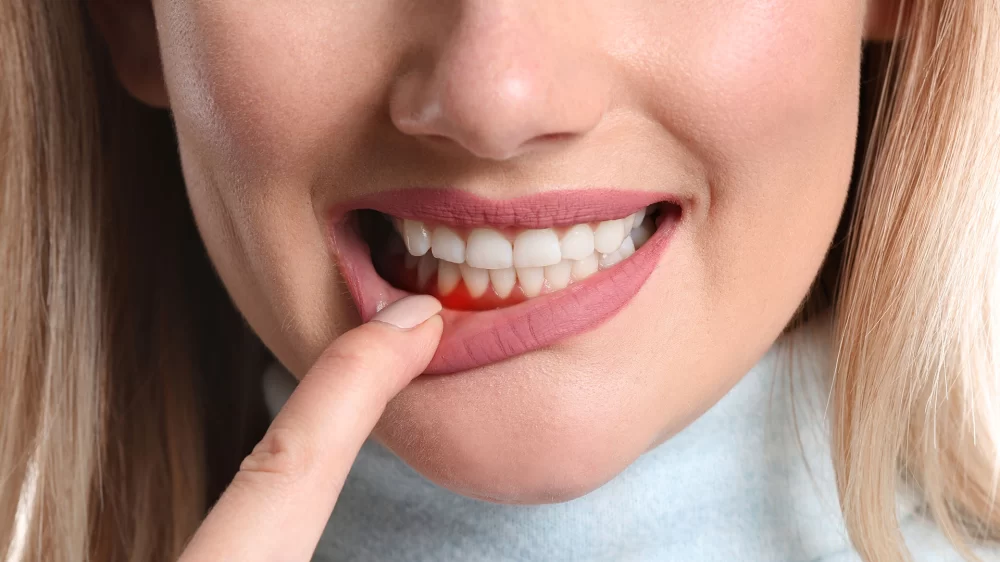 The Importance of Oral Hygiene in Preventing Systemic Diseases and Conditions