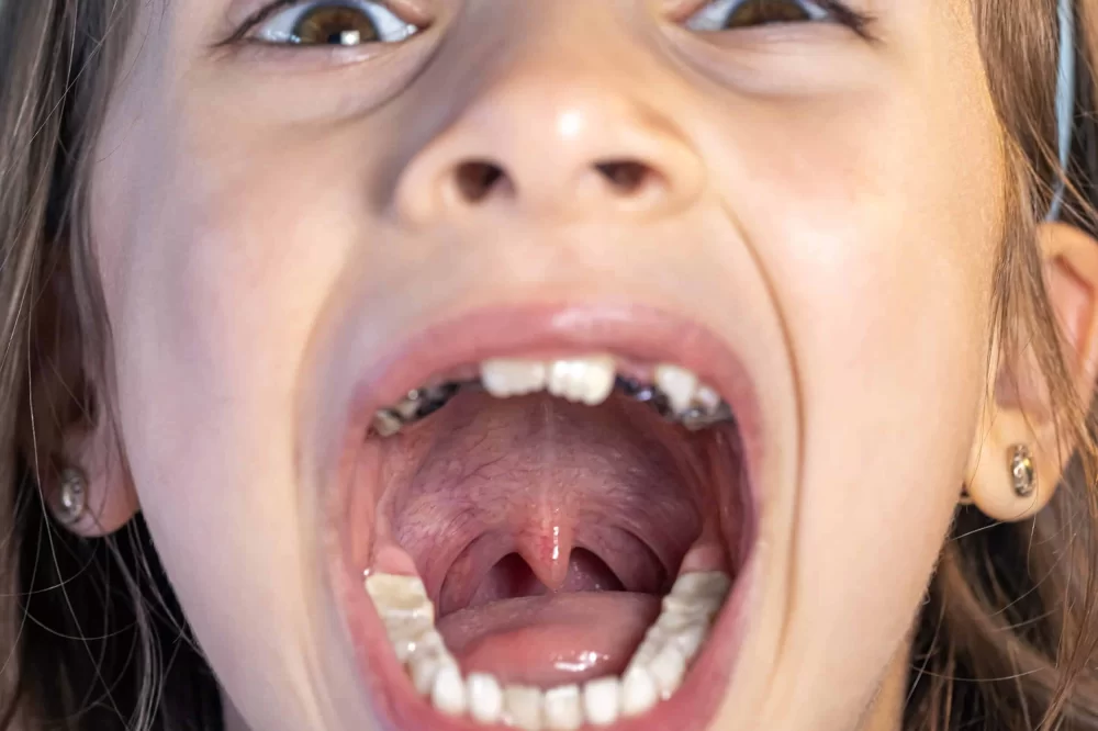 Signs of Oral HPV Infection in Adults and How to Manage Treatment Effectively