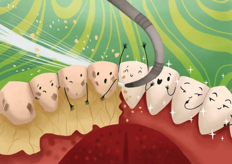 Best Toothpaste for Plaque and Tartar Control: Expert Recommendations