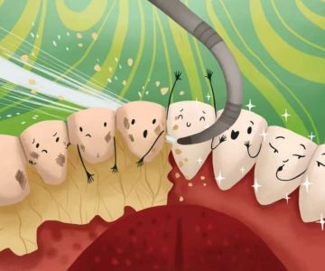 Best Toothpaste for Plaque and Tartar Control: Expert Recommendations