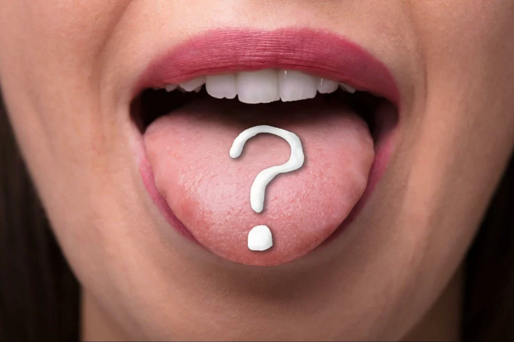 Understanding Causes of Black Spots on Tongue Related to Oral Health