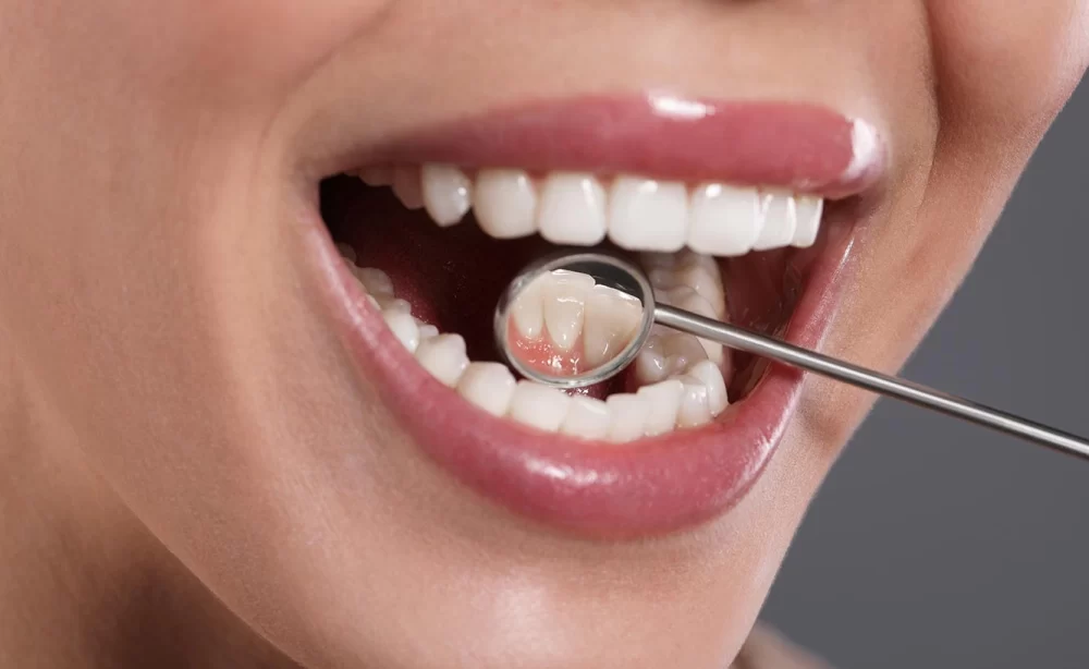 How Dentists Check for Oral Cancer: Comprehensive Guide for Early Detection