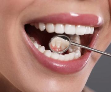 How Dentists Check for Oral Cancer: Comprehensive Guide for Early Detection