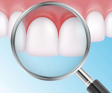 Is This Oral Cancer or Periodontal Disease? Understanding Key Differences