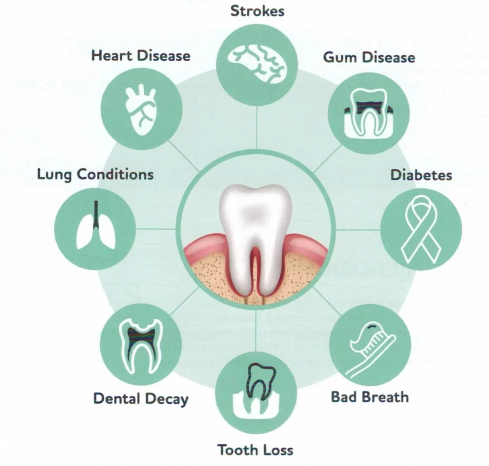 What Is the Definition of the Word Oral Disease and Its Impact on Health