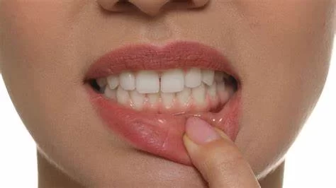 Serious Health Issues Caused by Bad Oral Hygiene and How to Prevent Them