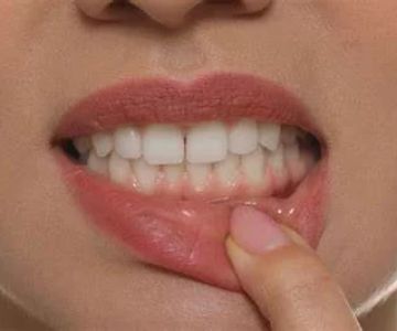 Serious Health Issues Caused by Bad Oral Hygiene and How to Prevent Them