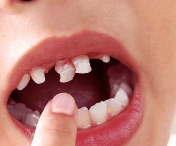 How to Prevent Teeth Grinding in Children: Expert Tips for Parents