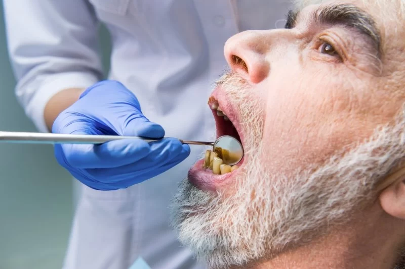 Can Poor Oral Hygiene Cause Cancer? Understanding the Risks and Prevention