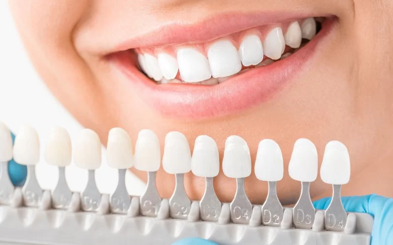 How to Care for Dental Implants After Cleaning – Expert Daily Guide