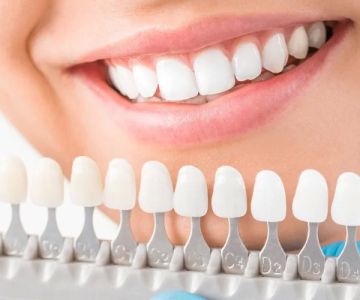 How to Care for Dental Implants After Cleaning – Expert Daily Guide