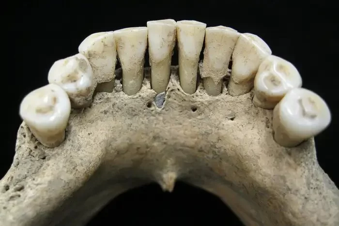 Was Oral Hygiene Practiced in Medieval Times? Uncovering the Truth