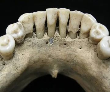 Was Oral Hygiene Practiced in Medieval Times? Uncovering the Truth