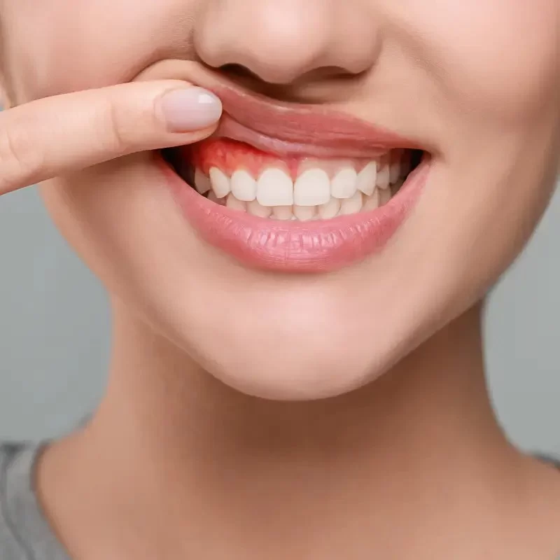 How Important Is Your Oral Hygiene: Benefits, Tips & Real Stories