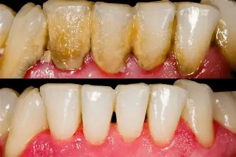 Do's and Don'ts for Oral Hygiene: Tips for a Healthy Smile