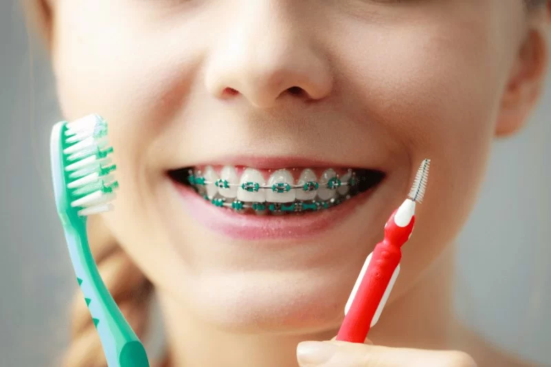 How to Maintain Good Oral Hygiene with Braces Effectively