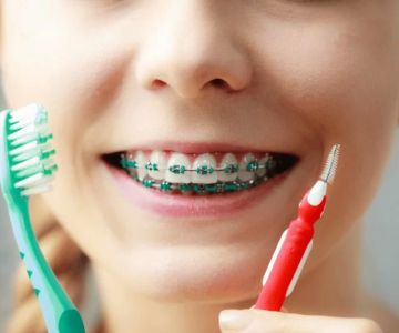 How to Maintain Good Oral Hygiene with Braces Effectively
