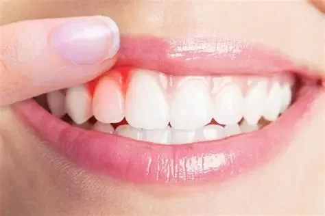 How Gum Disease Can Affect More Than Your Oral Health