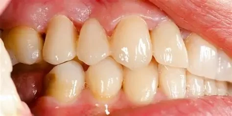 How Many Diseases Manifest in the Oral Cavity and Their Impact