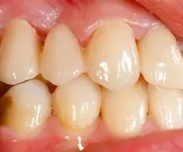 How Many Diseases Manifest in the Oral Cavity and Their Impact