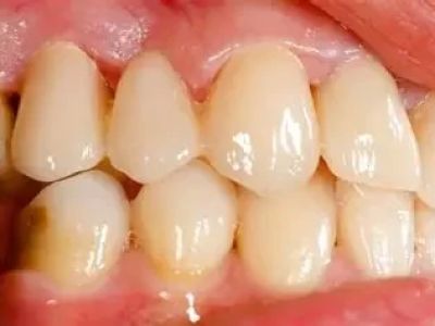How Many Diseases Manifest in the Oral Cavity and Their Impact