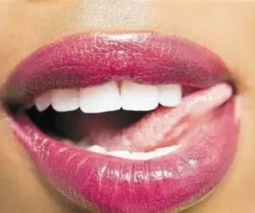 Diseases Transmitted Through Oral Sex: What You Need to Know