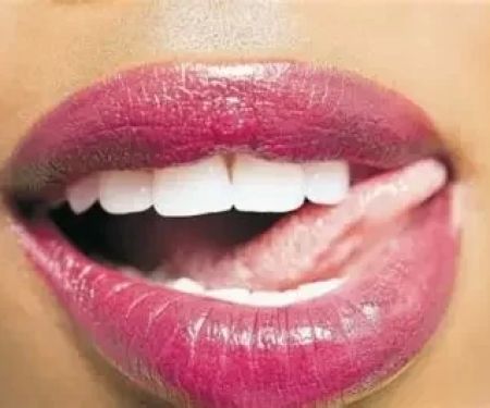 Diseases Transmitted Through Oral Sex: What You Need to Know