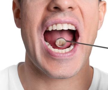 Signs of Oral Cancer Early Warning Signs and Detection Care