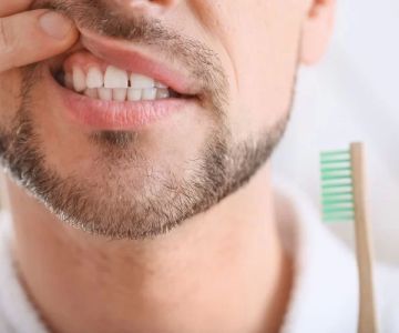 A Baumannii Oral Disease and Its Impact on Dental Health