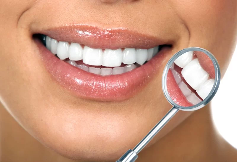 What is Oral Hygiene and How to Maintain a Healthy Smile?